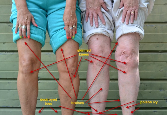 A map of the war wounds from the last two races!