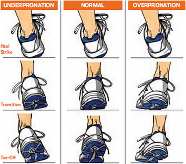 Pronation when you run.